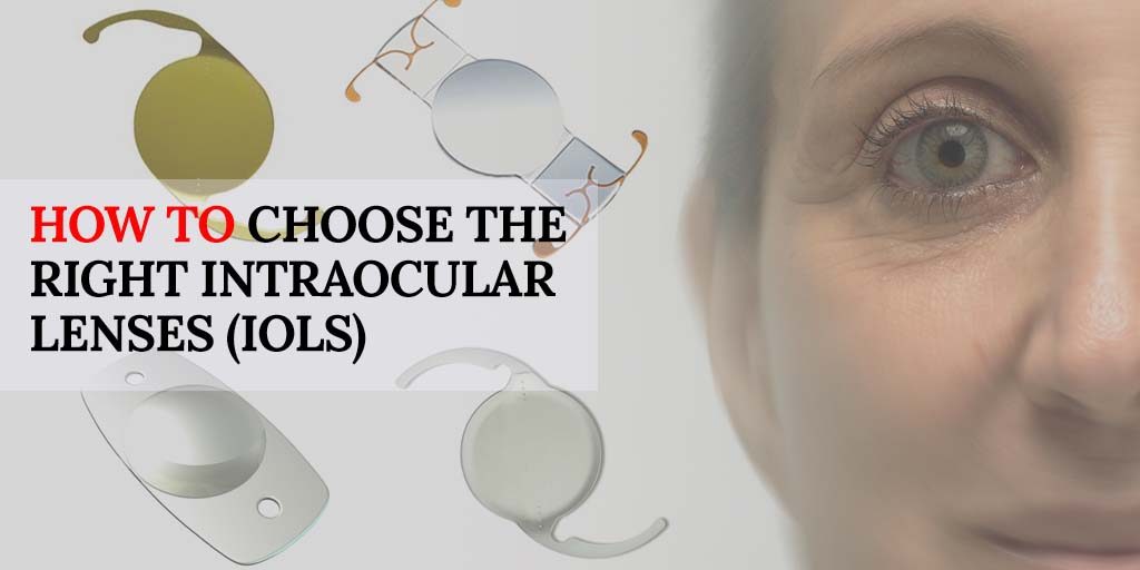 How to Choose the Right Intraocular Lenses (IOLs)