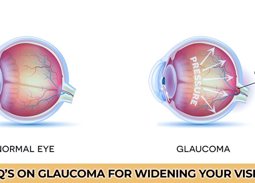 FAQ’s on Glaucoma for widening your vision