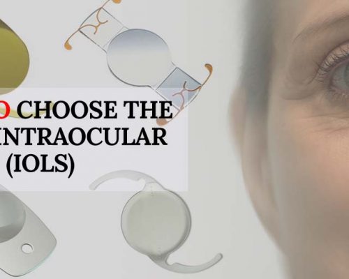 How to Choose the Right Intraocular Lenses (IOLs)
