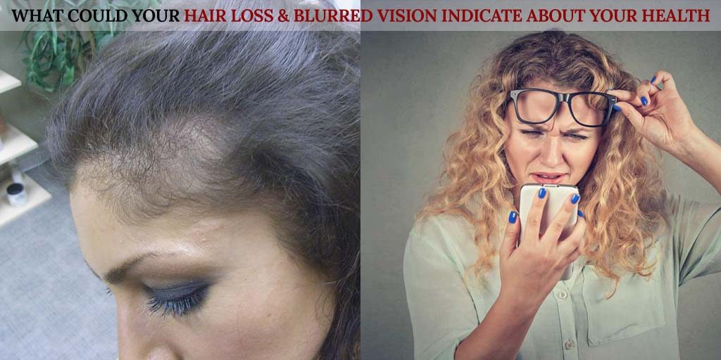 What could Your Hair Loss & Blurred Vision Indicate About Your Health ?