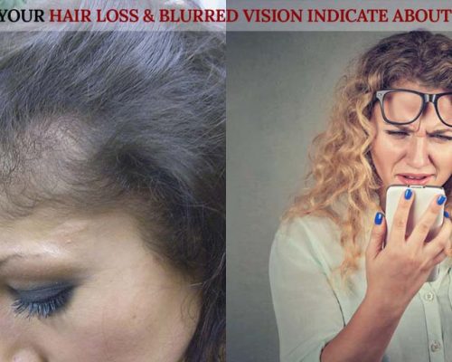 What could Your Hair Loss & Blurred Vision Indicate About Your Health ?
